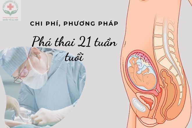 phá thai 21 tuần